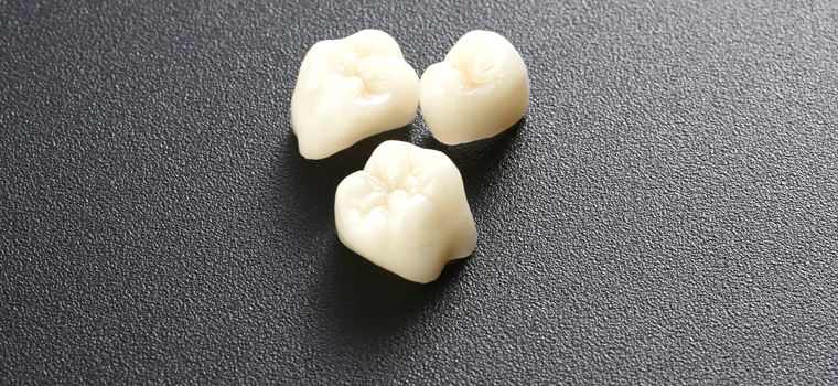 審美歯科（銀歯を白い歯へ）